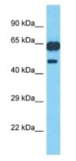 PM20D1 Rabbit anti-Human, Polyclonal, Novus Biologicals 25 &mu;g; Unconjugated:Antibodies,